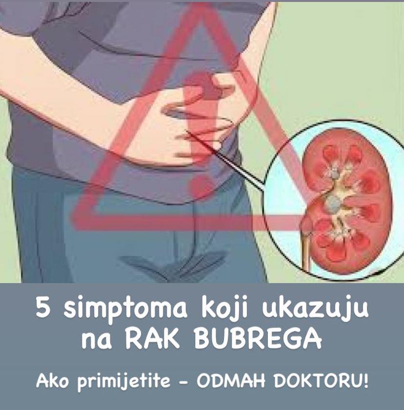 5 SIMPTOMA KOJI UKAZUJU NA RAK BUBREGA: Morate ih shvatit ozbiljno!