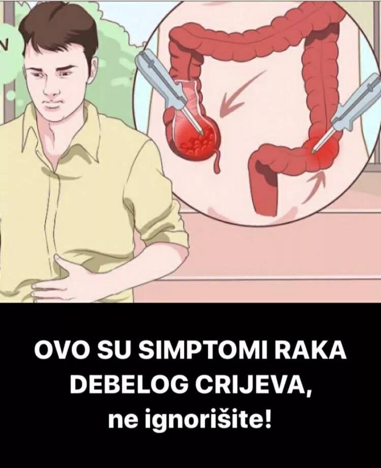 AKO IMATE OVE SIMPTOME, ODMAH KOD LJEKARA: 5 znakova da se u tijelu razvija RAK DEBELOG CRIJEVA, OBRATITE PAŽNJU!