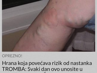 Hrana koja povećava rizik od nastanka TROMBA:  Svaki dan ovo unosite u organizam, A MOŽE VAS DOVESTI DO SMRTI