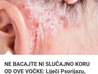 NE BACAJTE NI SLUČAJNO KORU OD OVE VOĆKE: Liječi Psorijazu, Skida Bradavice I Izbjeljuje Zube!