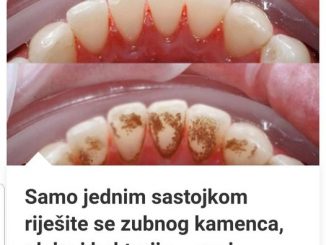 Samo jednim sastojkom riješite se zubnog kamenca, plaka i bakterija – ovaj sastojak već imate u kući