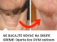 NE BACAJTE N0VAC NA SKUPE KREME:  Operite Lice OVIM Začinom I BORE Će Nestati Kao Rukom Odnešene