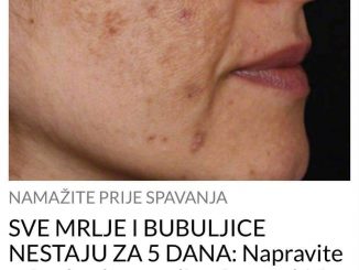 SVE MRLJE I BUBULJICE NESTAJU ZA 5 DANA:  Napravite prirodnu kremu, lice će vam biti kao u bebe