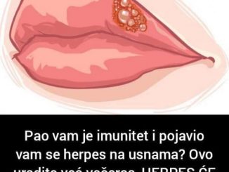 Pao vam je imunitet i pojavio vam se herpes na usnama?  Ovo uradite već večeras, HERPES ĆE NESTATI U REKORDNOM PERIODU