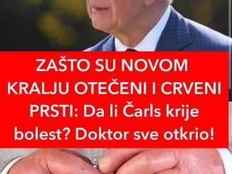 ZAŠTO SU NOVOM KRALJU OTEČENI I CRVENI PRSTI:  Da li Čarls krije bolest? Doktor sve otkrio!