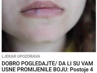 DOBRO POGLEDAJTE/ DA LI SU VAM USNE PROMIJENILE BOJU:  Postoje 4 razloga za ovo stanje, A JEDNO JE POSEBNO OPASNO