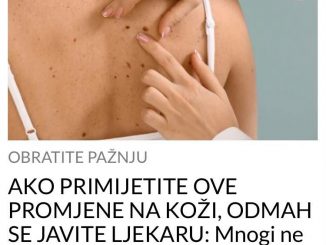 AKO PRIMIJETITE OVE PROMJENE NA KOŽI, ODMAH SE JAVITE LJEKARU:  Mnogi ne obraćaju pažnju, a mogu da ukažu na SMRTONOSNU BOLEST