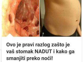 Ovo je pravi razlog zašto je vaš stomak NADUT i kako ga smanjiti preko noći!