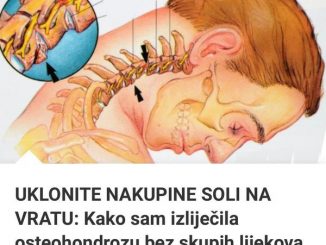 UKLONITE NAKUPINE SOLI NA VRATU: Kako Sam Izliječila Osteohondrozu Bez Skupih Lijekova