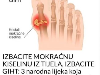 IZBACITE MOKRAĆNU KISELINU IZ TIJELA, IZBACITE GIHT: 3 narodna lijeka koja provjereno djeluju, OVO ĆE VAM POMOĆ